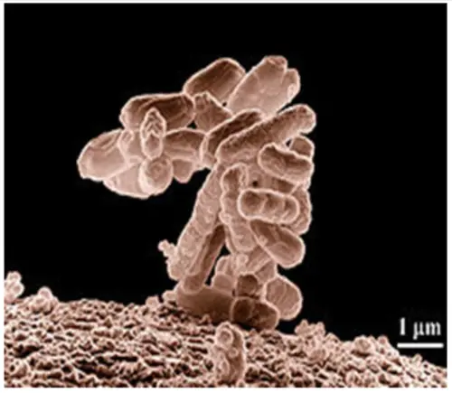 micrografía bacteria E Coli